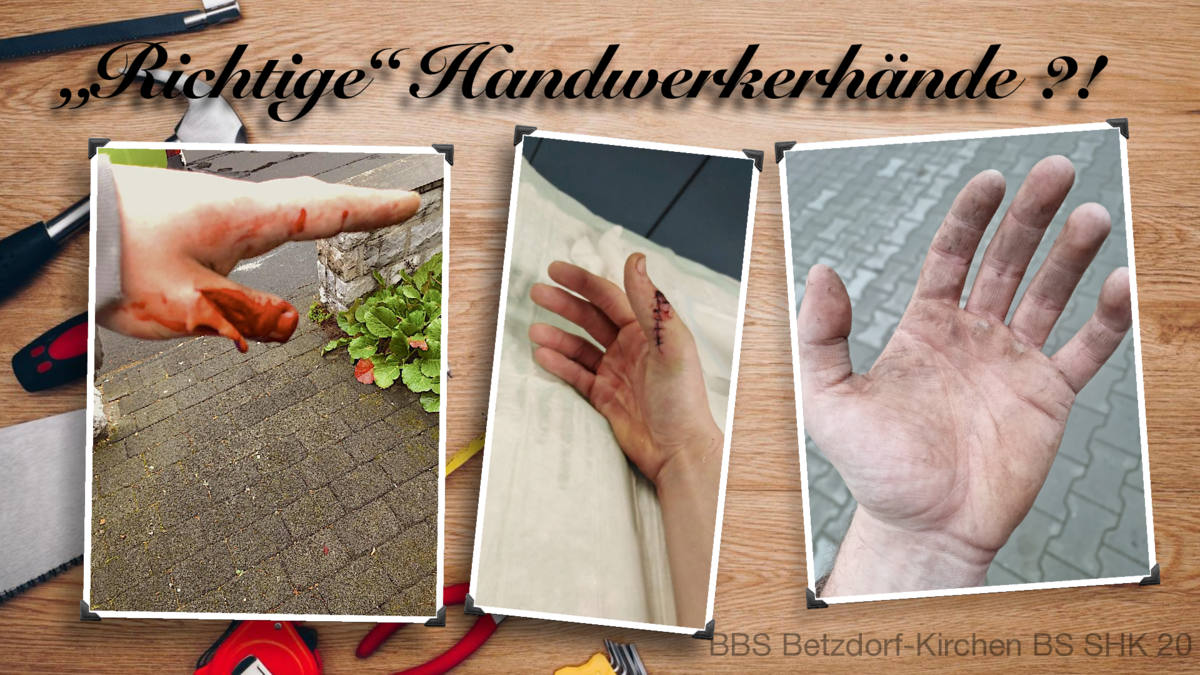 Unfallbilder mit Überschrift "Richtige Handwerkerhände?"